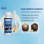 OSADA OSADI Minoxidil 5% Hair & Beard Growth Solution for Men (4-Pack)