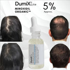 Minoxidil 5% Organic Hair Growth Tonic – 2-Piece Set for Thicker, Stronger Hair