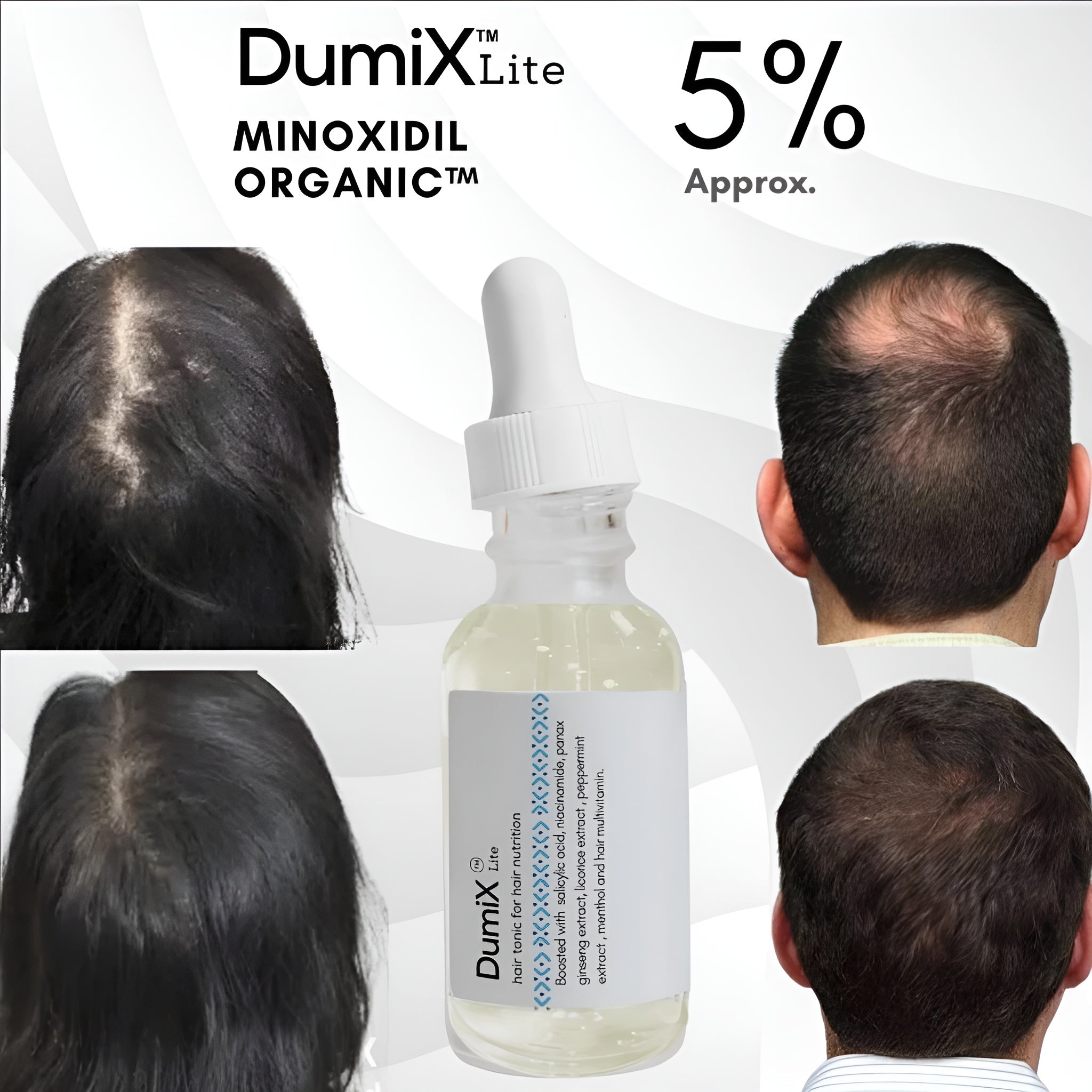 Minoxidil 5% Organic Hair Growth Tonic – 2-Piece Set for Thicker, Stronger Hair