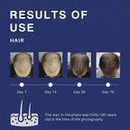 ROEGAN Minoxidil 5% for Men | BPOM Registered & Halal Hair and Beard Growth Solution