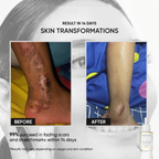 D’SAVIOR Body Oil 100ml | Helps Reduce Scars, Eczema, Psoriasis, Stretch Marks & Allergy Itching