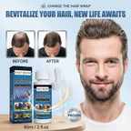 OSADA OSADI Minoxidil 5% Hair & Beard Growth Solution for Men (4-Pack)