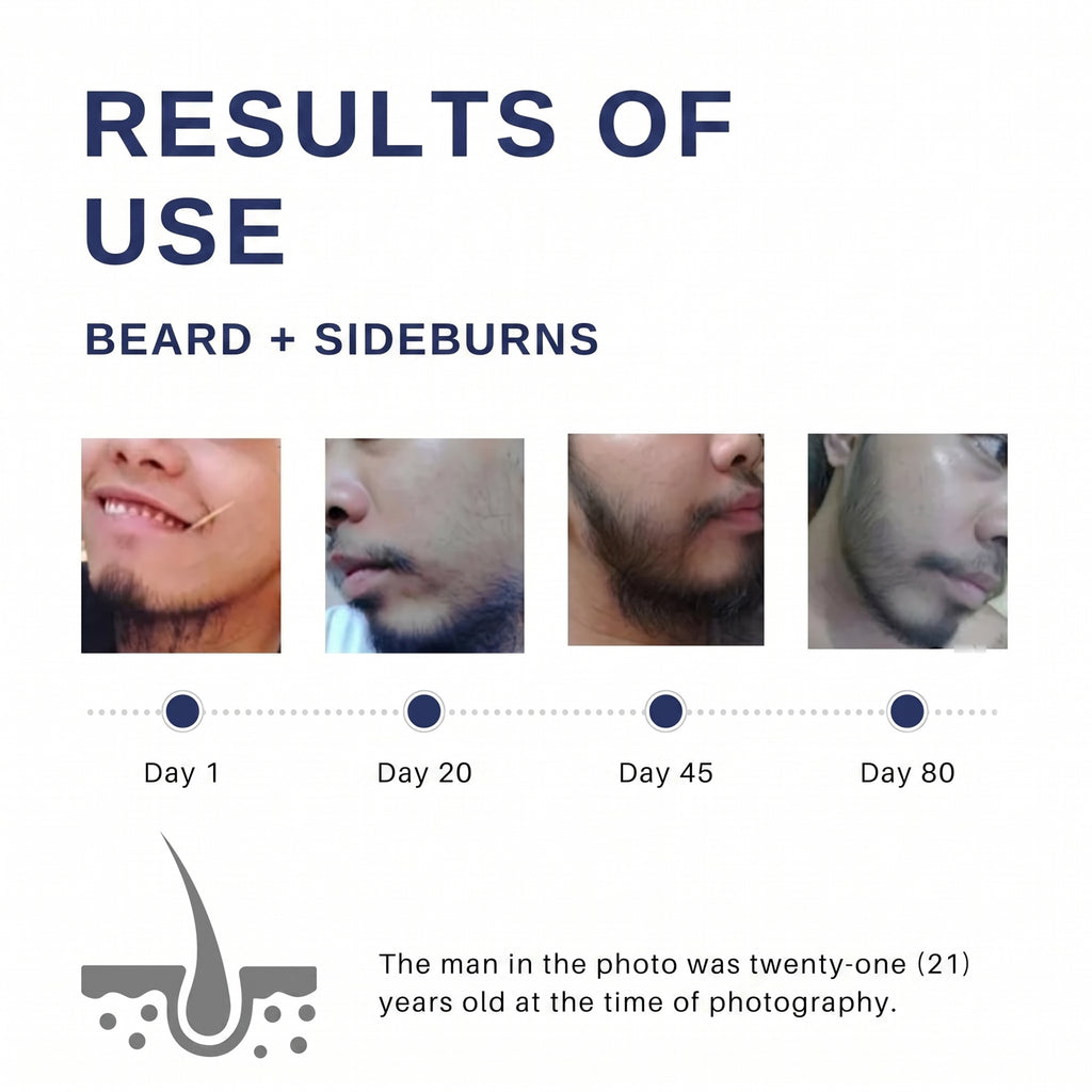 ROEGAN Minoxidil 5% for Men | BPOM Registered & Halal Hair and Beard Growth Solution