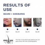 ROEGAN Minoxidil 5% for Men | BPOM Registered & Halal Hair and Beard Growth Solution