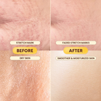 Buttered Almond Dry Body Oil 100ml | 60% Cold-Pressed Sweet Almond Oil, Vitamin E, Antioxidants & Stretch Mark Care