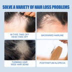 OSADA OSADI Minoxidil 5% Hair & Beard Growth Solution for Men (4-Pack)