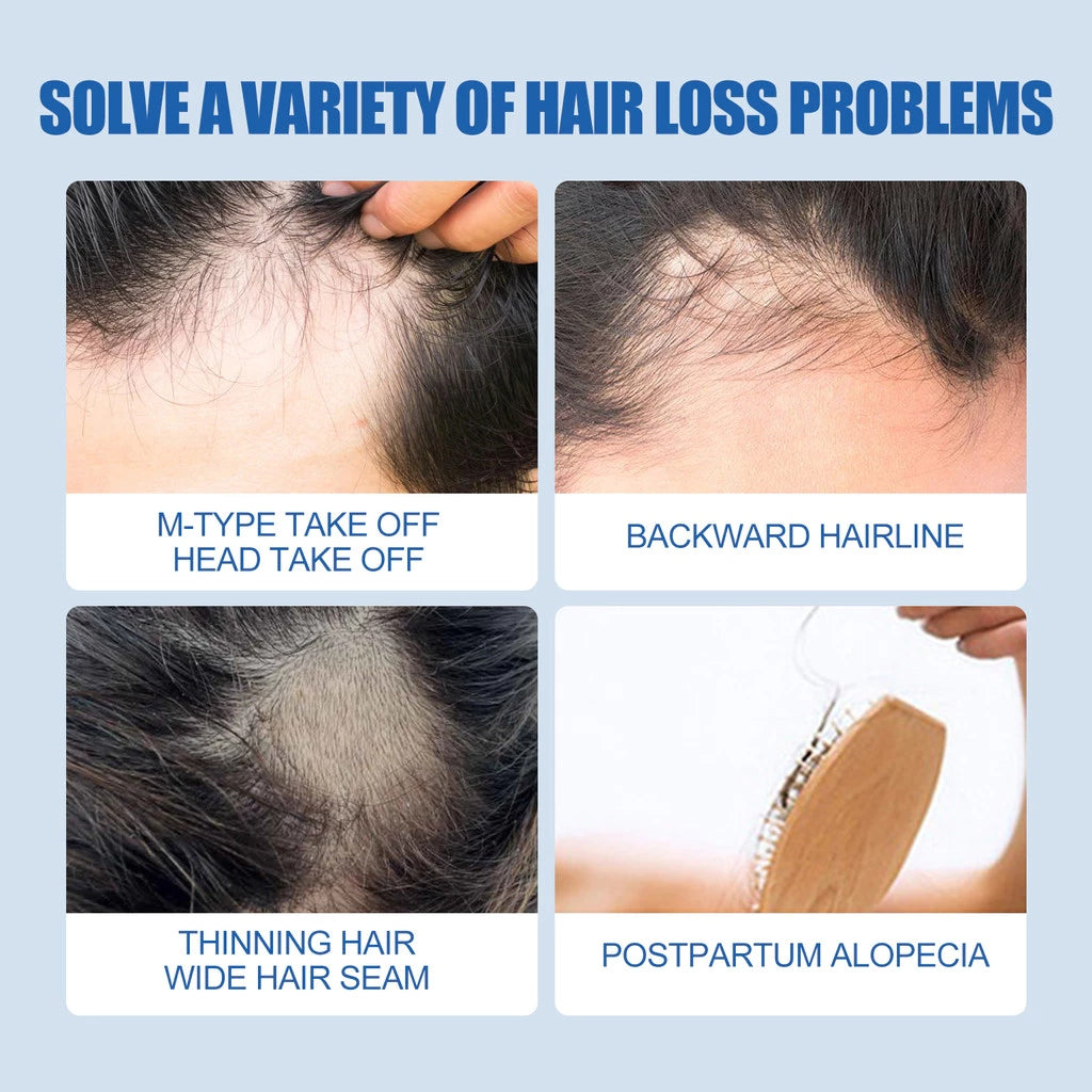 OSADA OSADI Minoxidil 5% Hair & Beard Growth Solution for Men (4-Pack)