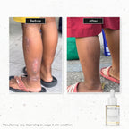 D’SAVIOR Body Oil 100ml | Helps Reduce Scars, Eczema, Psoriasis, Stretch Marks & Allergy Itching
