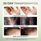 Lab On Hair Scalp Spray Hair Tonic Anti Hair Loss Strengthening Scalp Care