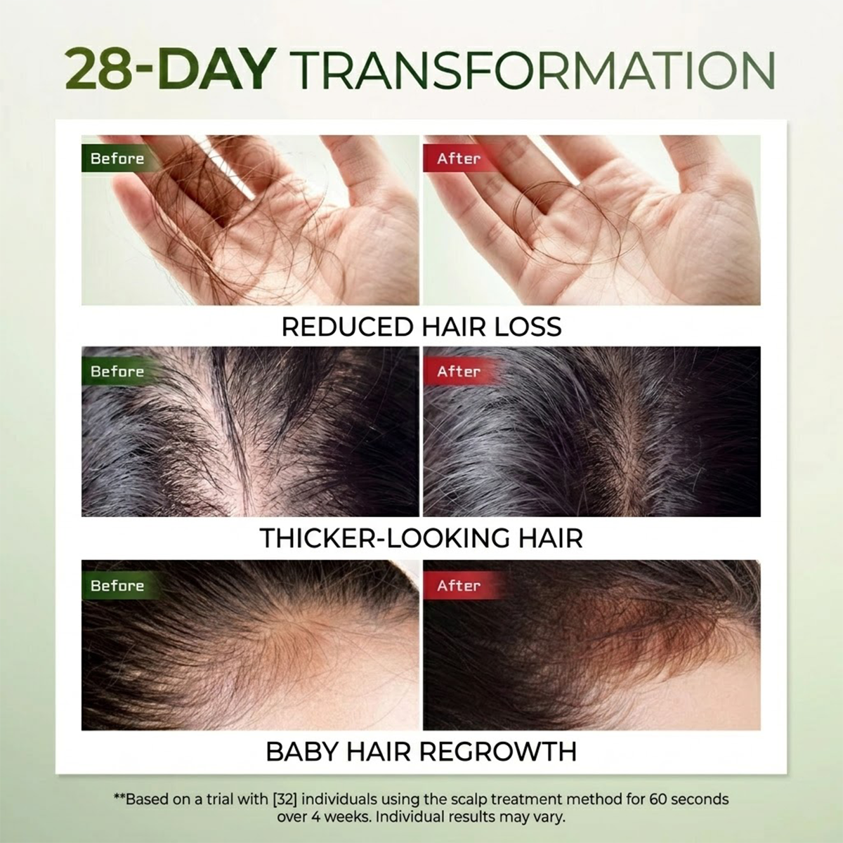 Lab On Hair Scalp Spray Hair Tonic Anti Hair Loss Strengthening Scalp Care