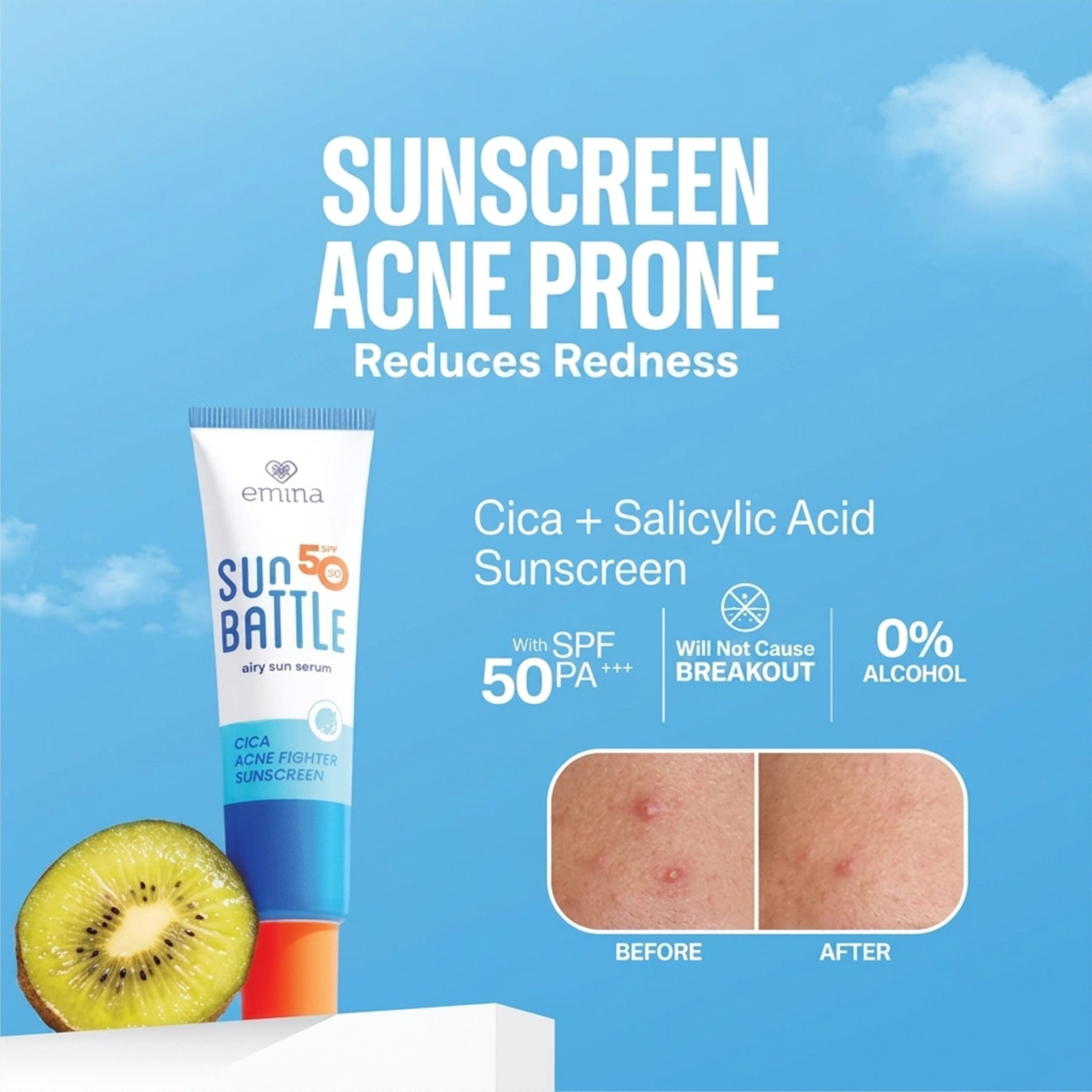Emina Sun Battle SPF 50 PA++++ Cica Acne Fighter Sunscreen (3 pcs)